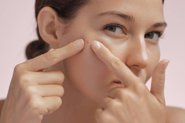 What Makes Our Acne Facial Different?