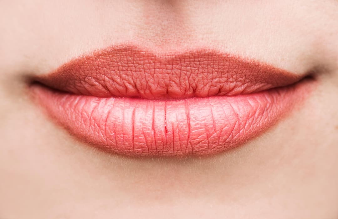Fordyce Spots on the Lips: What They Are and How We Treat Them in Irvine