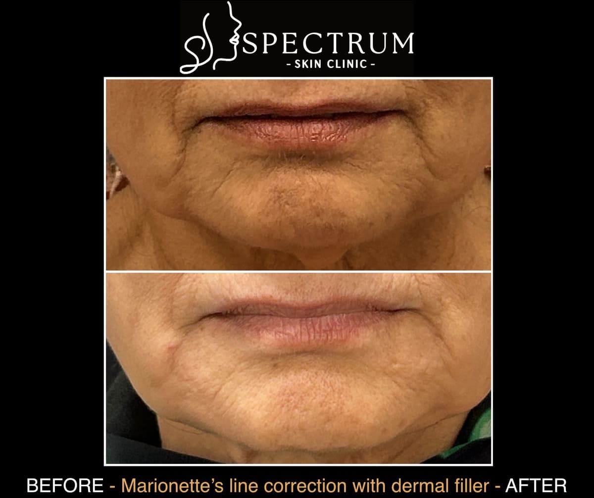 Luxury Combination Therapies