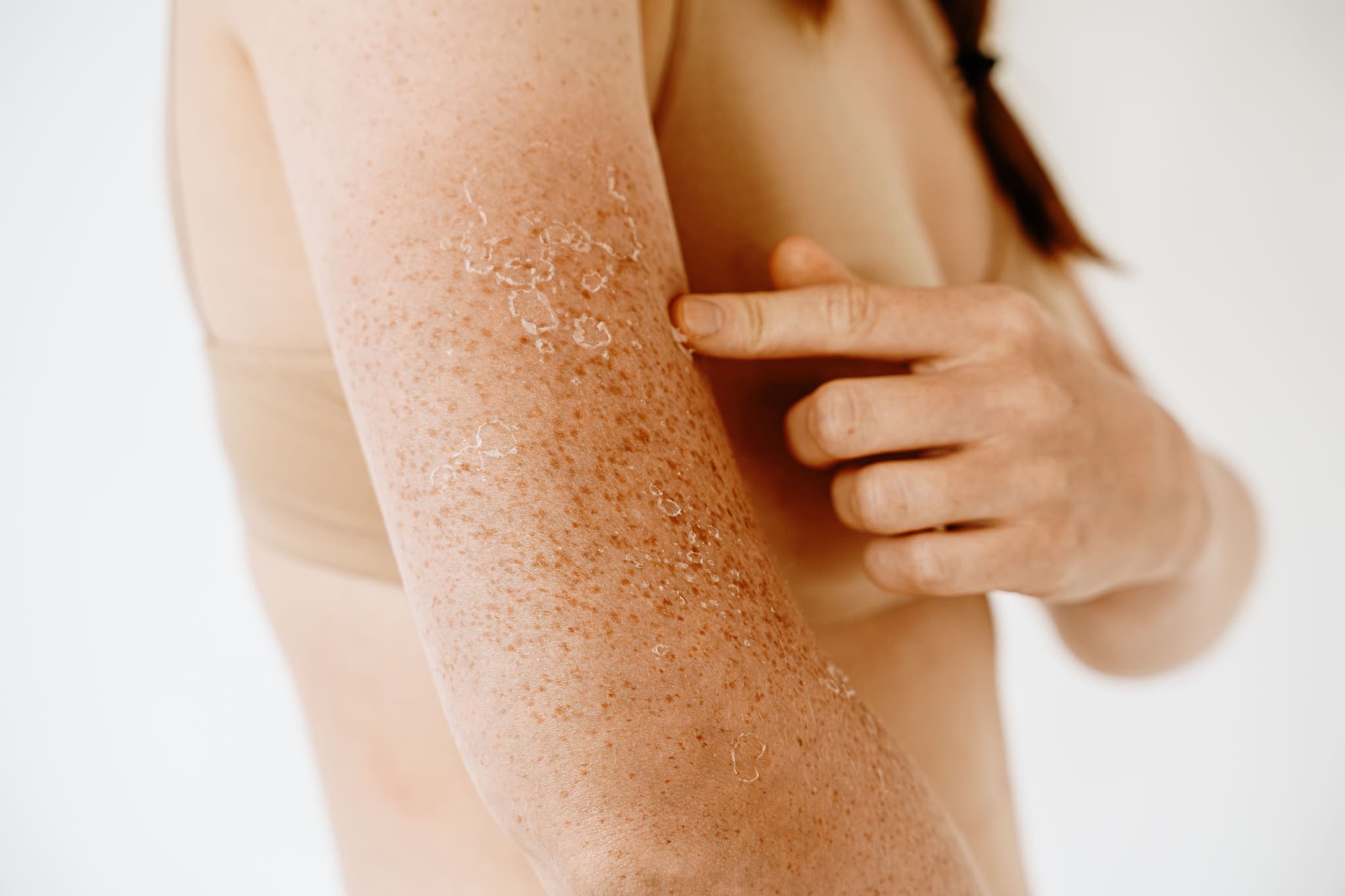 Nordlys Light & Bright: Comprehensive Skin Rejuvenation for Pigmentation and Texture