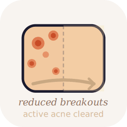Reduced Active Breakouts
