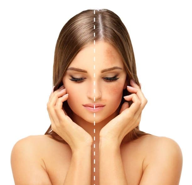 What can I expect during treatment?