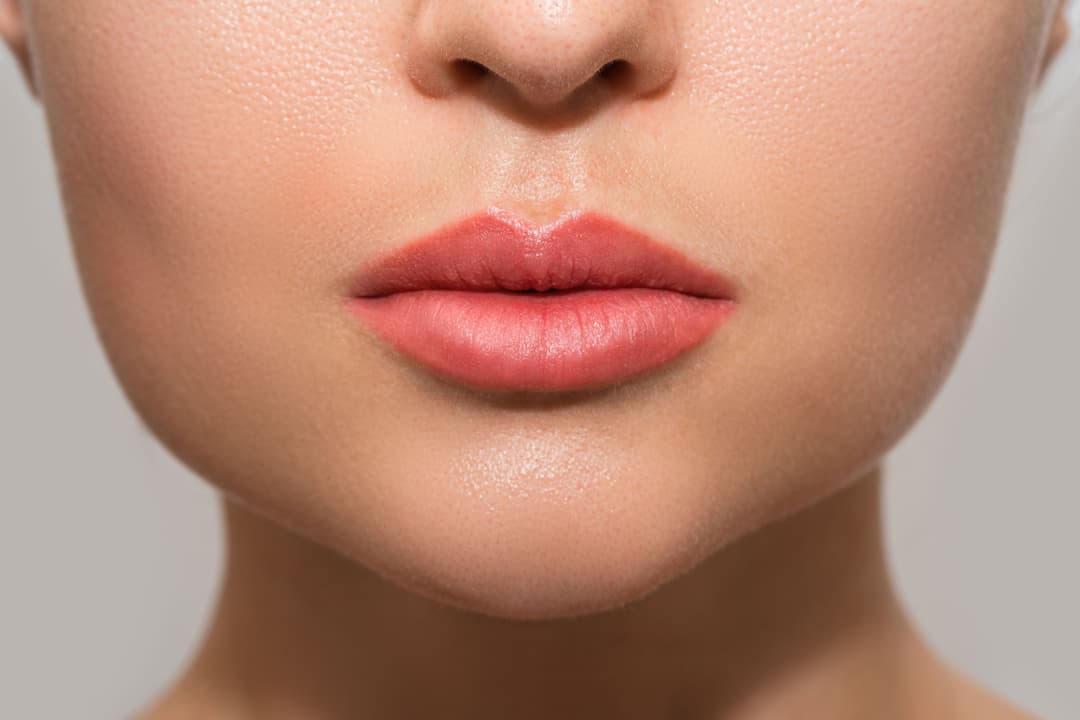 Lip Filler Dissolve