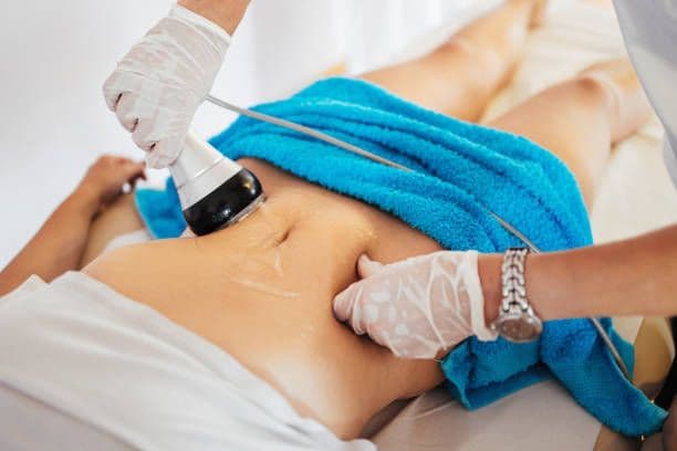 What can I expect during the procedure?