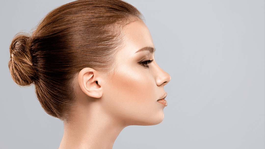 Kybella