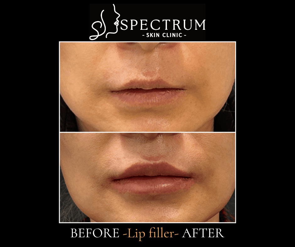 What the Before and After Actually Shows